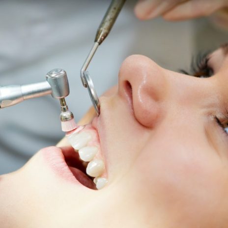 Dental-Cleaning-Consultation
